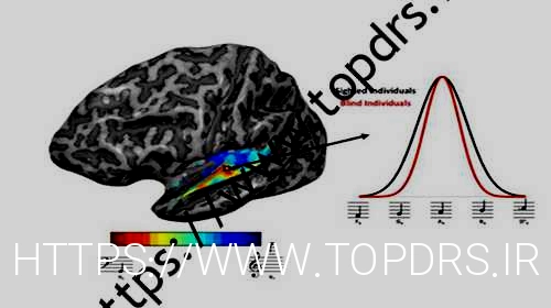 مغز پیانیست نابینا دانشمندان را شگفت زده کرد: